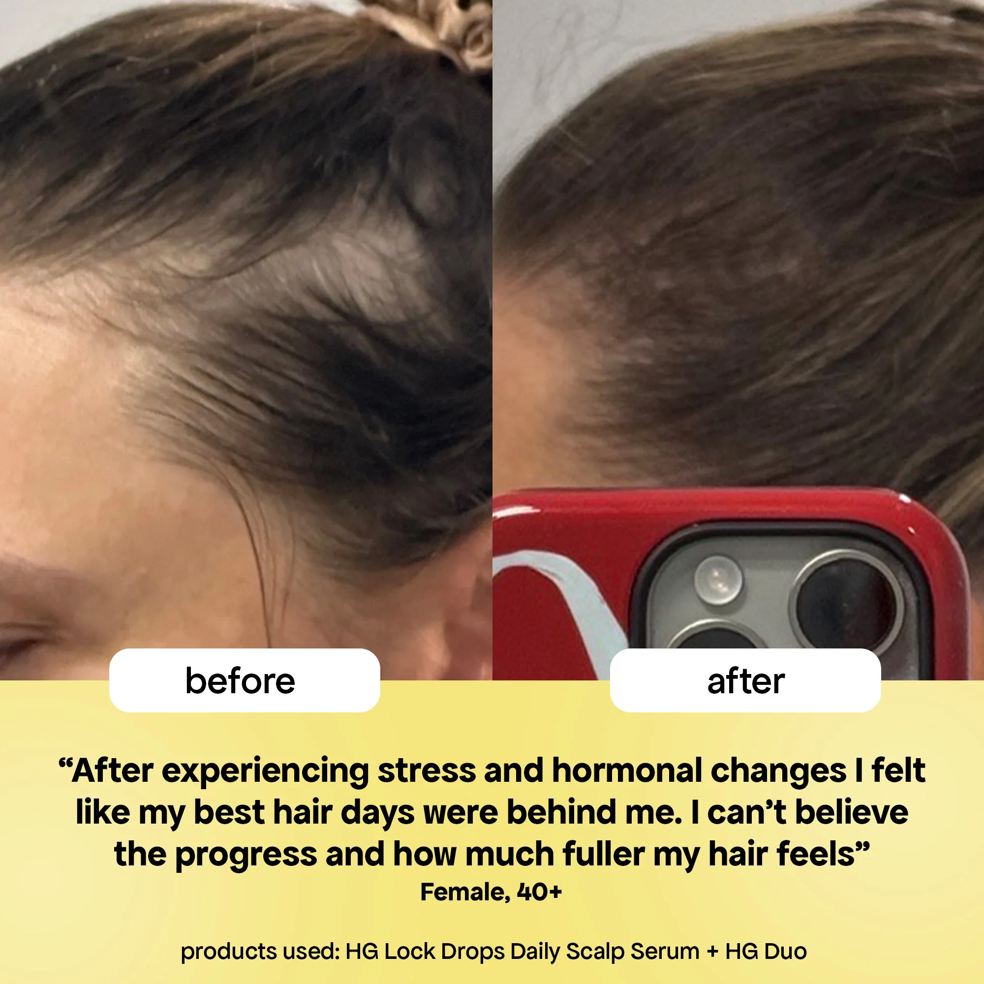 LOCK DROPS ANTI-SHEDDING SCALP & HAIR SERUM - Image 4