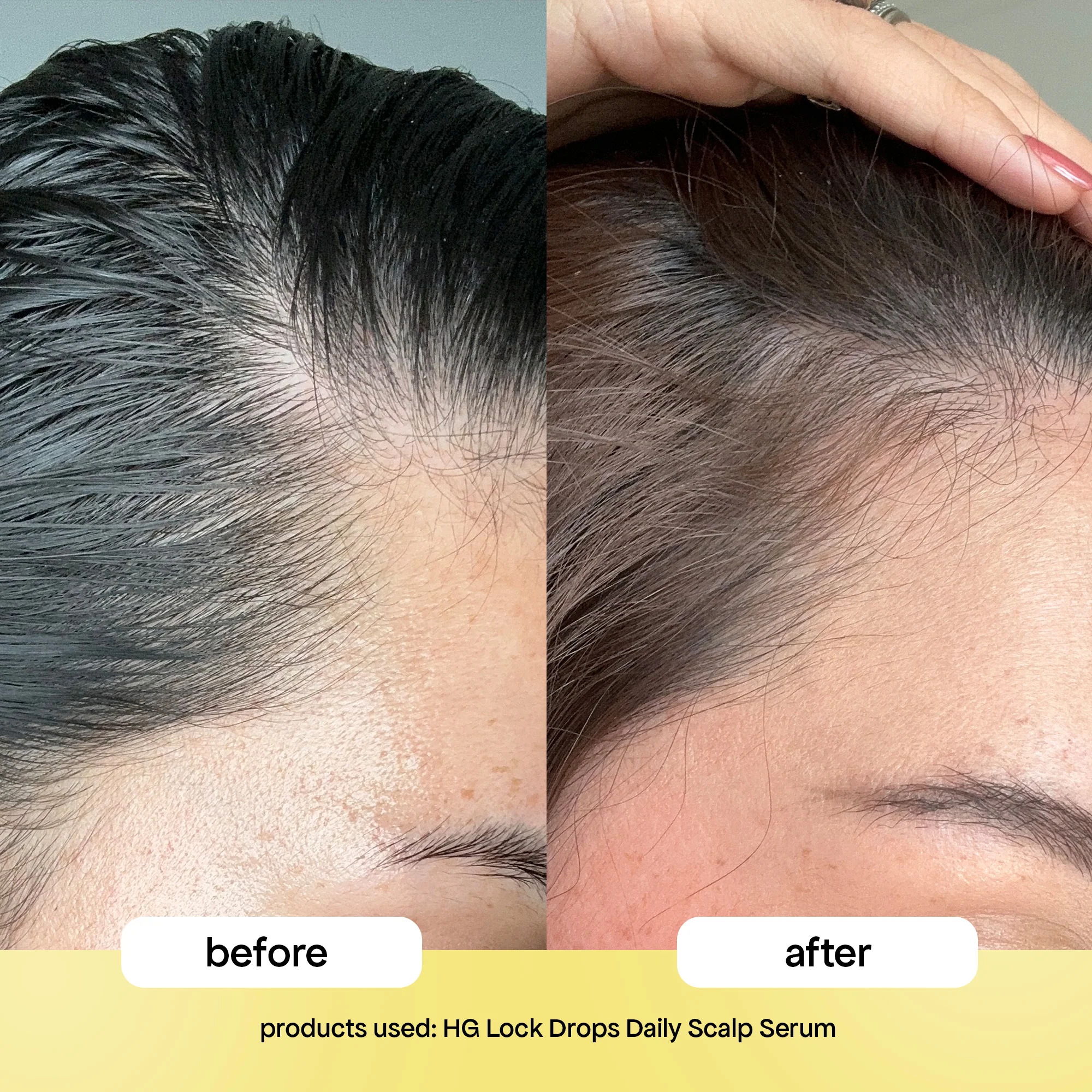 LOCK DROPS ANTI-SHEDDING SCALP & HAIR SERUM - Image 3