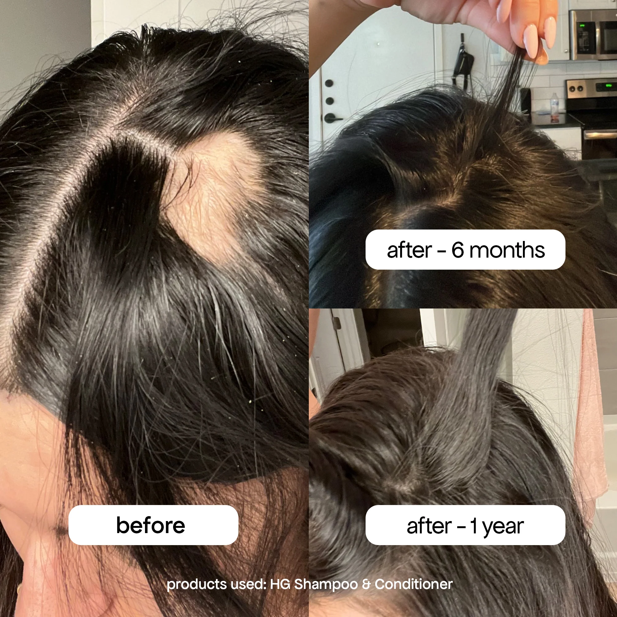 ANTI-THINNING SHAMPOO & CONDITIONER DUO - Image 3