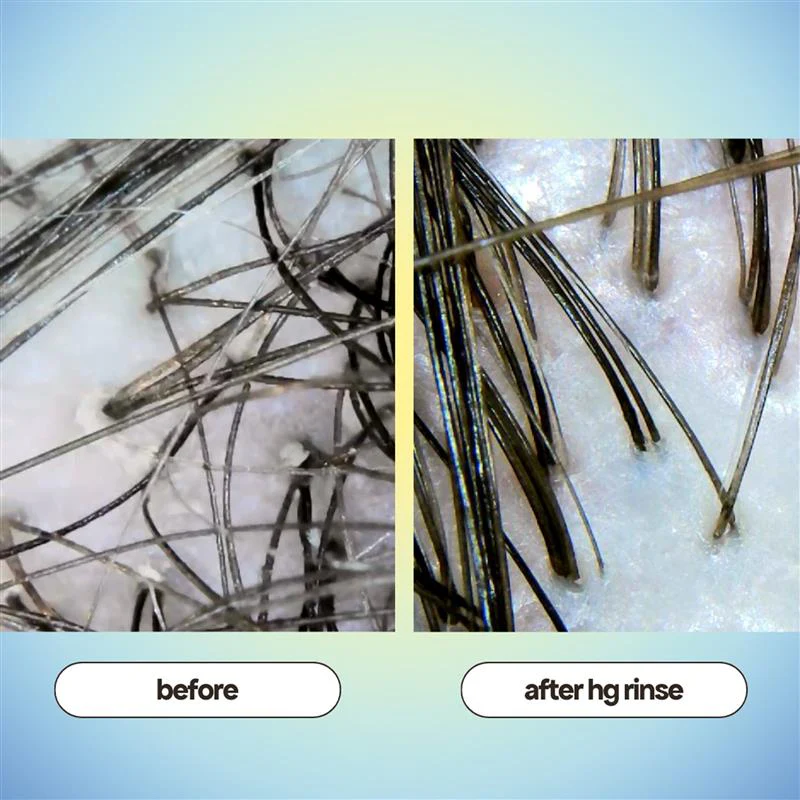 CLARIFYING SCALP & HAIR RINSE - Image 2