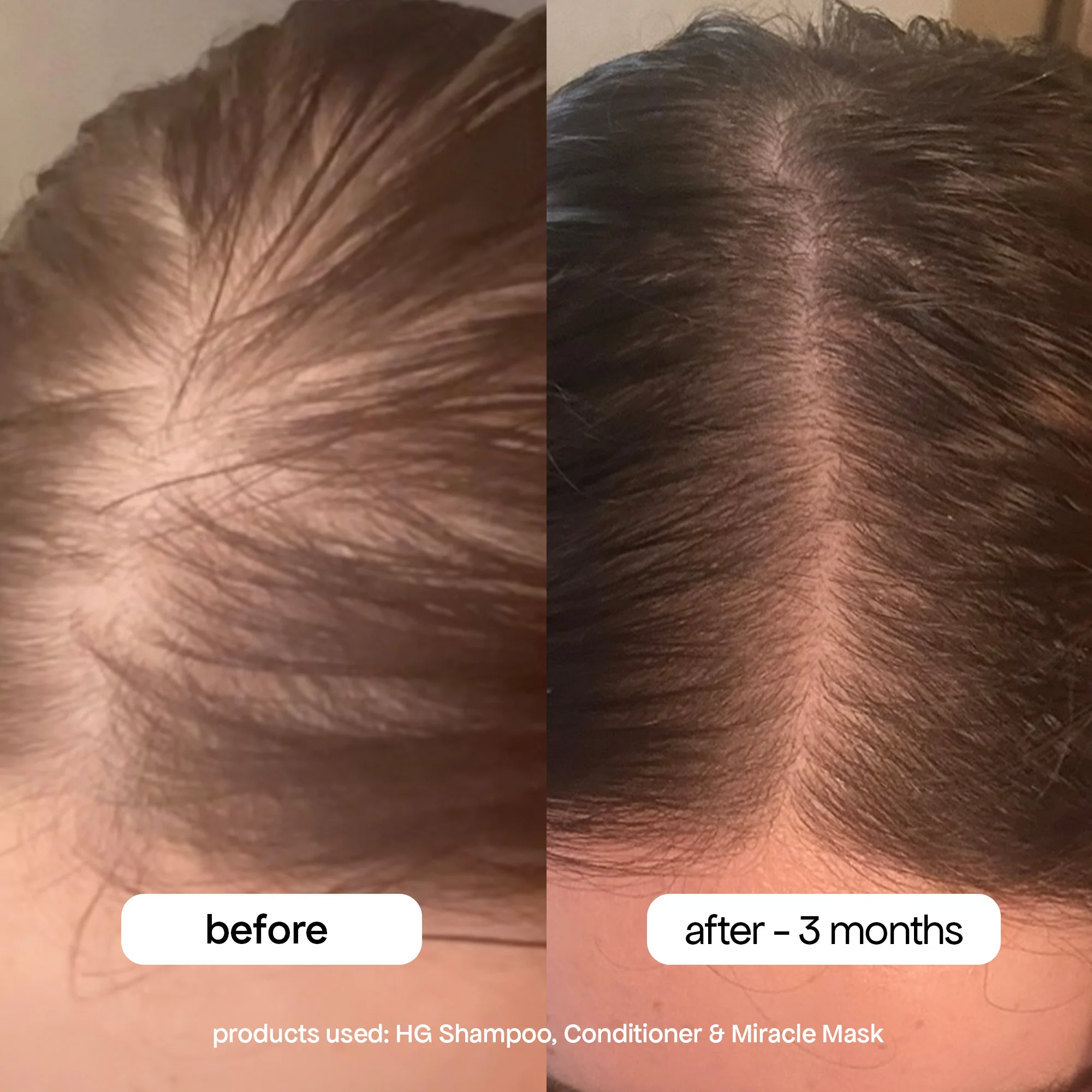 ANTI-THINNING CONDITIONER - Image 13