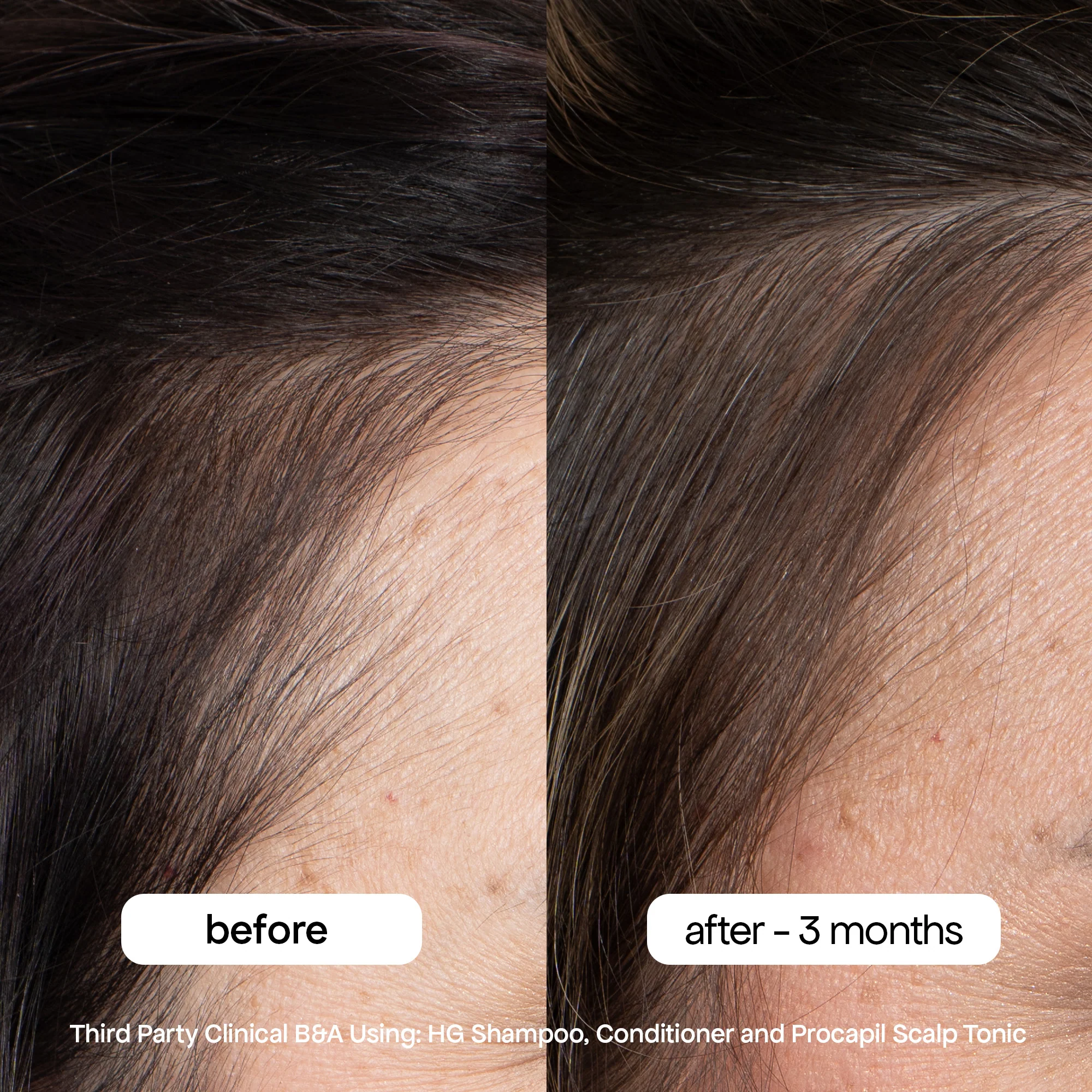 ANTI-THINNING SHAMPOO & CONDITIONER DUO - Image 4
