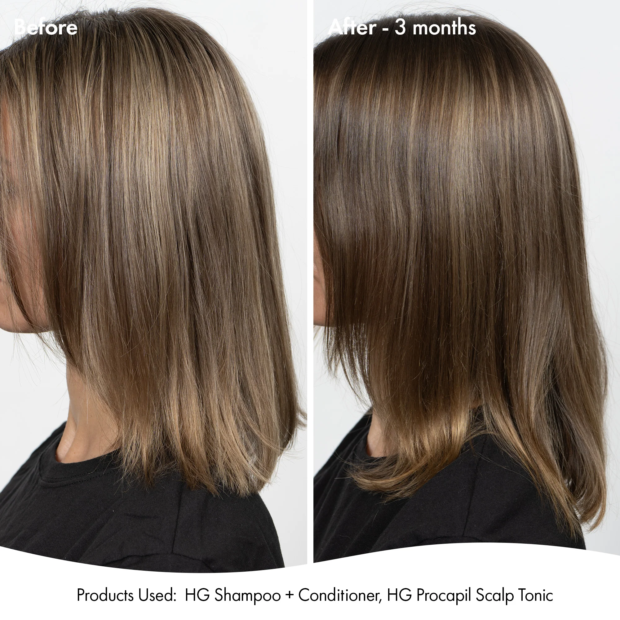 ANTI-THINNING SUPER SYSTEM - Image 2