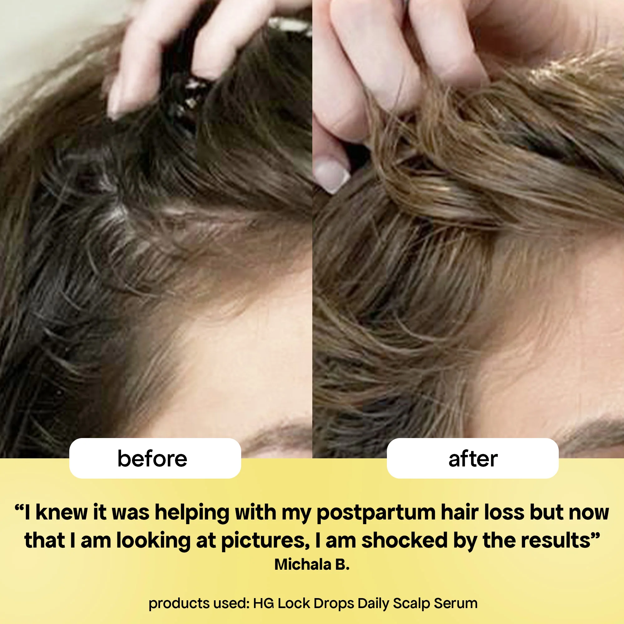 LOCK DROPS ANTI-SHEDDING SCALP & HAIR SERUM - Image 7