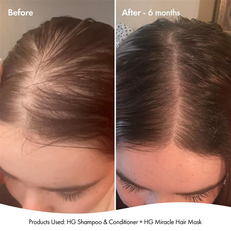 MIRACLE HAIR MASK - Image 2